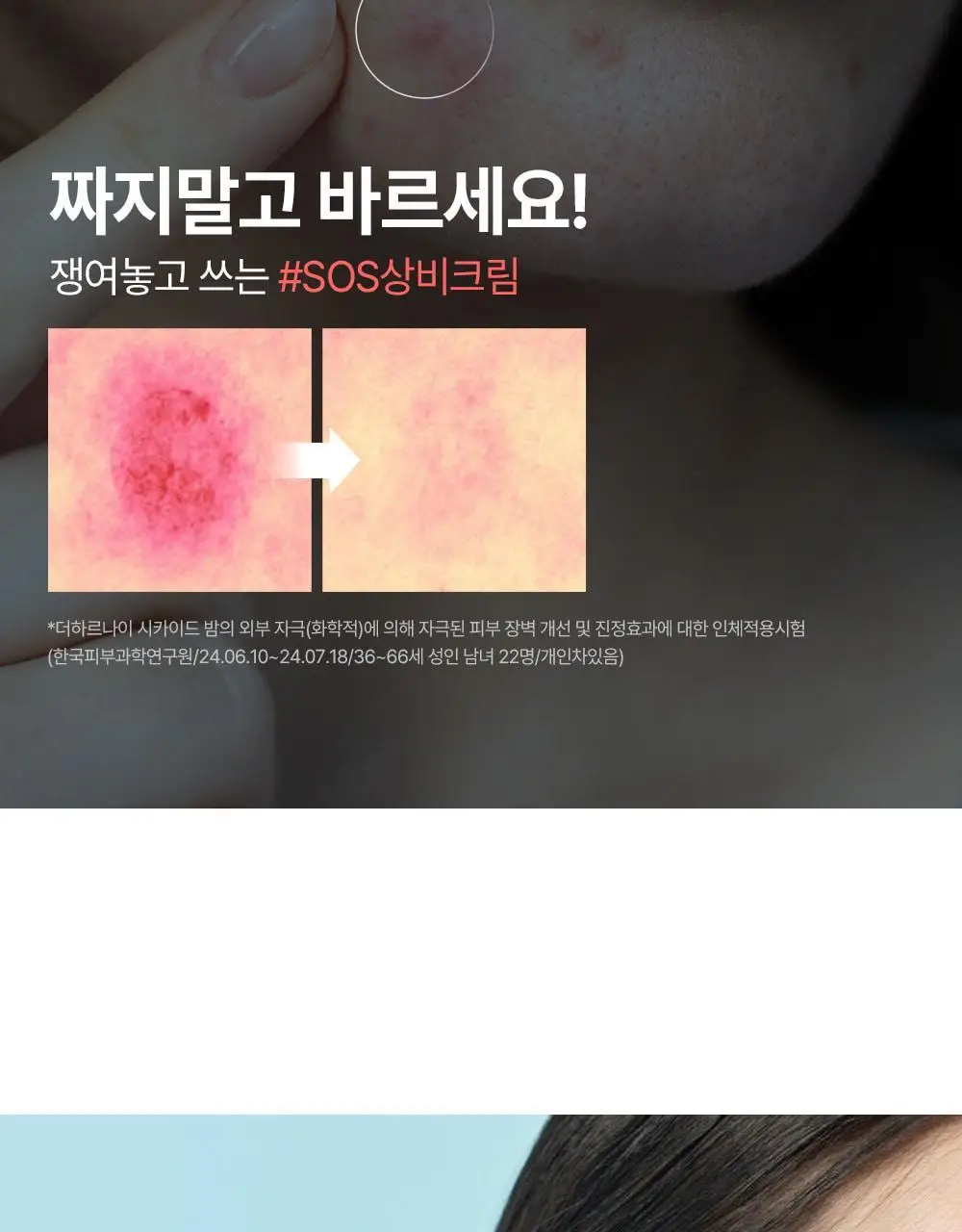 [피부장벽강화크림] 더하르나이 시카이드 밤 100ml기획(+앰플5ml*3p+크림5ml*2p) 상세페이지 4